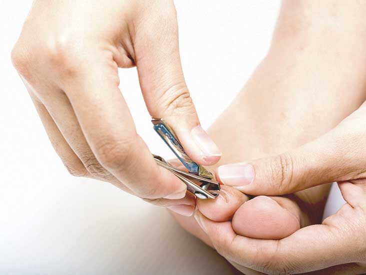 Trim Toenails Regularly